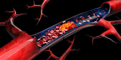 revista-rai-inmunohematologia-salud-sangre-3dilustracion-fondo-negro-aislado-esclerosis-cerebral